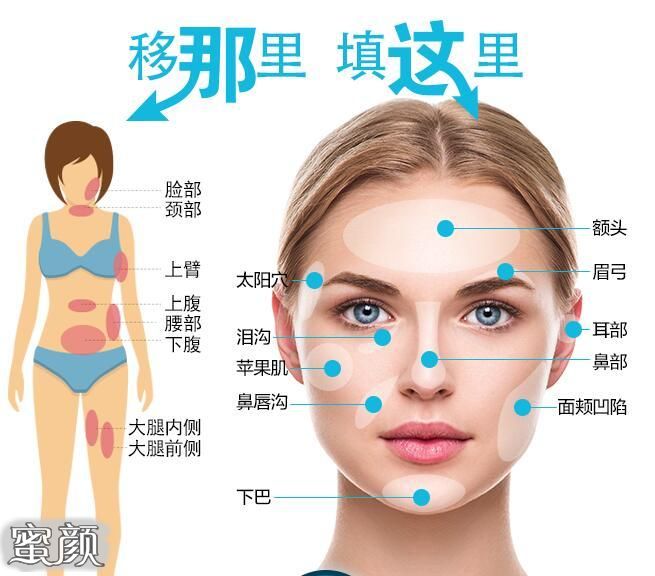 https://img.miyanlife.com/mnt/Editor/2020-10-23/5f9286a5730b1.jpg