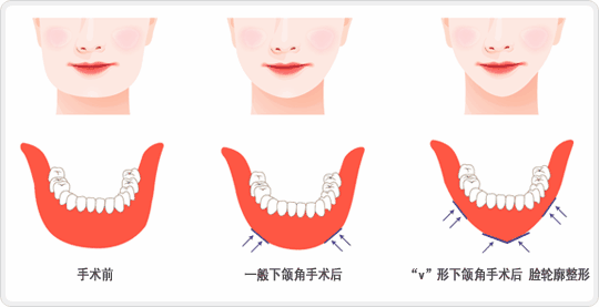 https://img.miyanlife.com/mnt/Editor/2020-10-23/5f928de415117.jpg