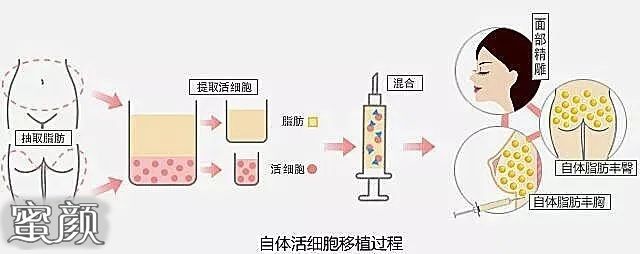 https://img.miyanlife.com/mnt/Editor/2020-10-25/5f953bab09a22.jpg