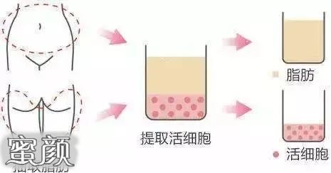 https://img.miyanlife.com/mnt/Editor/2020-10-25/5f953bc995725.jpg