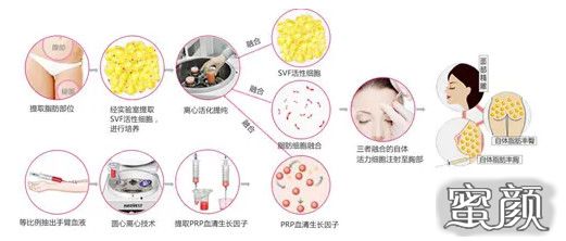 https://img.miyanlife.com/mnt/Editor/2020-10-25/5f95513a8207e.jpg