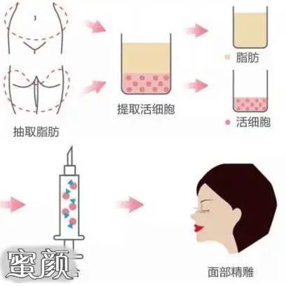 https://img.miyanlife.com/mnt/Editor/2020-10-25/5f955145c4417.jpg