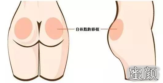 https://img.miyanlife.com/mnt/Editor/2020-10-29/5f9a97ce38429.jpg