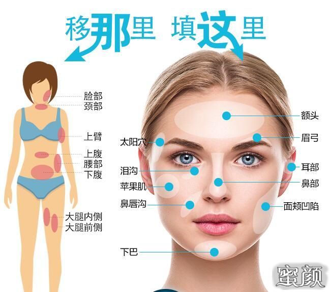 https://img.miyanlife.com/mnt/Editor/2020-10-29/5f9a98242f876.jpg