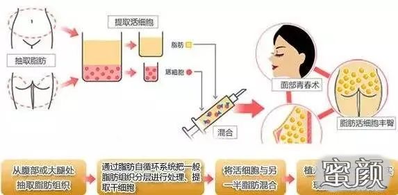 https://img.miyanlife.com/mnt/Editor/2020-10-29/5f9a984ec46ec.jpg