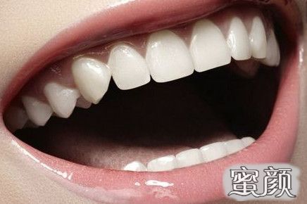 https://img.miyanlife.com/mnt/Editor/2020-10-31/5f9cdd868664a.jpg