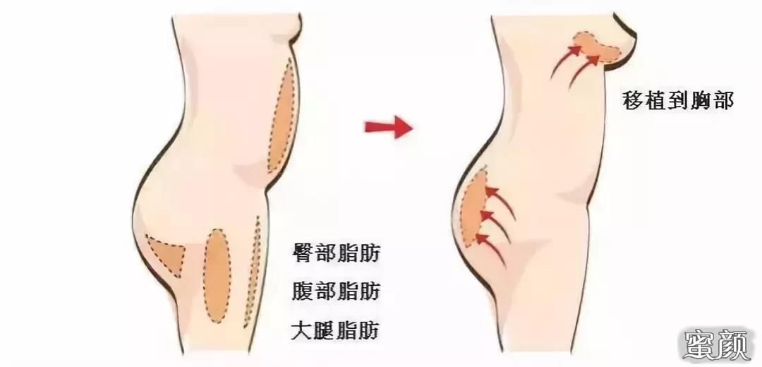 https://img.miyanlife.com/mnt/Editor/2020-11-04/5fa2669ea43e3.jpg