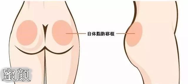 https://img.miyanlife.com/mnt/Editor/2020-11-04/5fa267092770e.jpg
