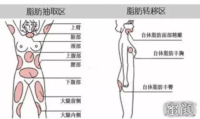 https://img.miyanlife.com/mnt/Editor/2020-11-04/5fa271b40c847.jpg
