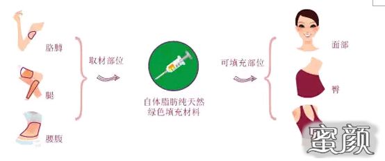 https://img.miyanlife.com/mnt/Editor/2020-11-04/5fa271d21c952.jpg