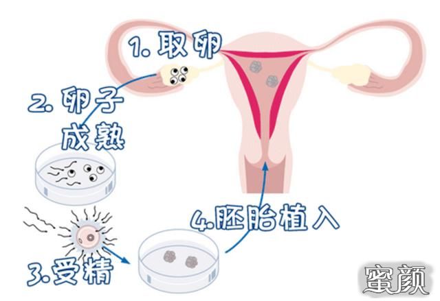https://img.miyanlife.com/mnt/Editor/2020-11-06/5fa511acda2ff.jpg