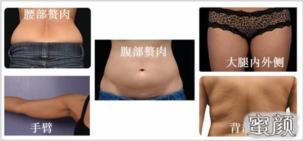 https://img.miyanlife.com/mnt/Editor/2020-11-10/5faa574078a4d.jpg