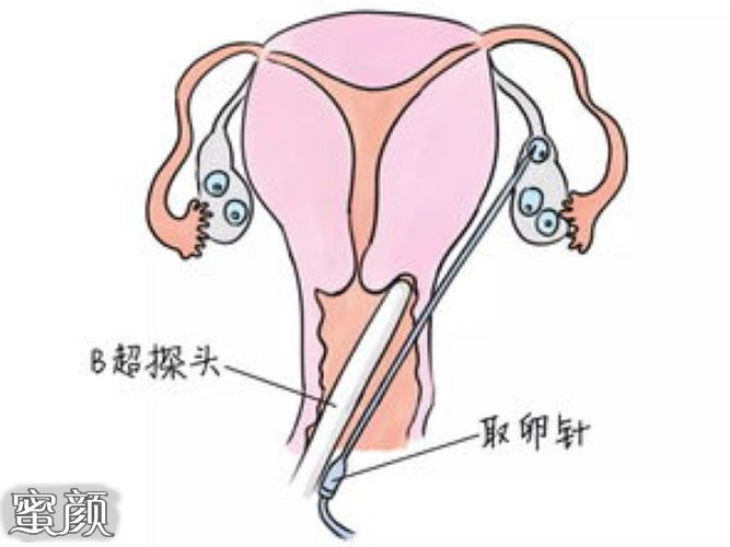 https://img.miyanlife.com/mnt/Editor/2020-11-10/5faaa7c947bea.jpg