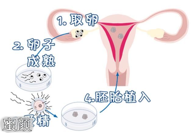 https://img.miyanlife.com/mnt/Editor/2020-11-12/5facc5f15750f.jpg