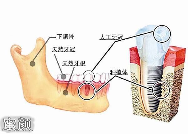 案例图片