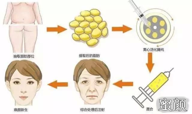 https://img.miyanlife.com/mnt/Editor/2020-11-12/5fad4d927bd45.jpg