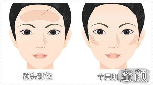 https://img.miyanlife.com/mnt/Editor/2020-11-12/5fad4dc0a7067.jpg