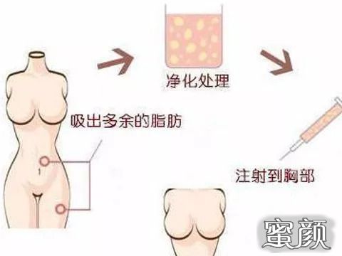 https://img.miyanlife.com/mnt/Editor/2020-11-12/5fad4de639212.jpg