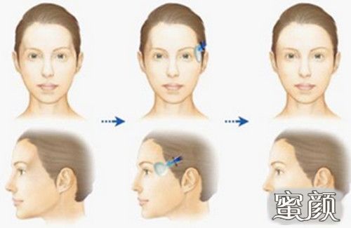 https://img.miyanlife.com/mnt/Editor/2020-11-12/5fad4eb04d554.jpg