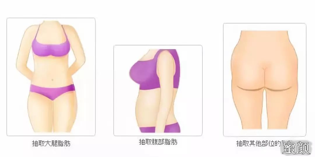 https://img.miyanlife.com/mnt/Editor/2020-11-12/5fad4ec5b645d.jpg