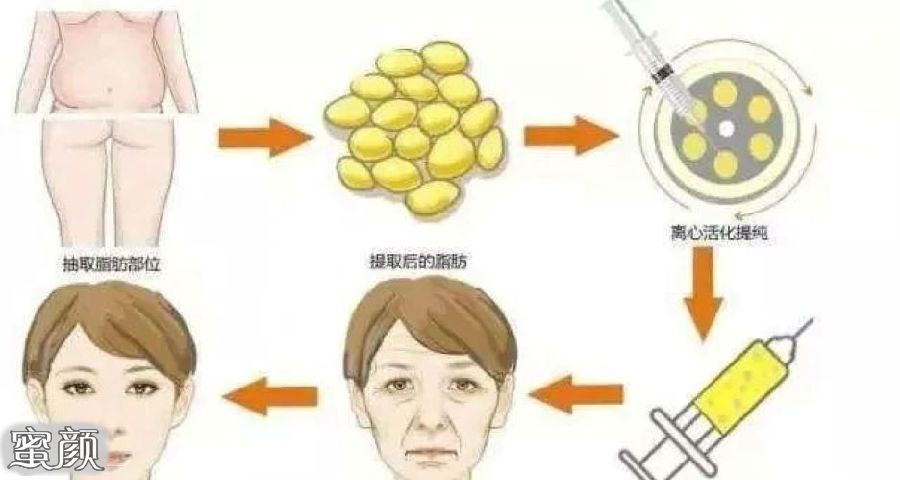https://img.miyanlife.com/mnt/Editor/2020-11-13/5fae907f322c1.jpg
