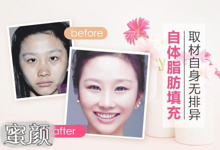 https://img.miyanlife.com/mnt/Editor/2020-11-13/5fae980f756d4.jpg