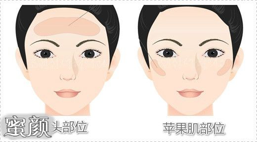 https://img.miyanlife.com/mnt/Editor/2020-11-13/5faea151a1ea1.jpg
