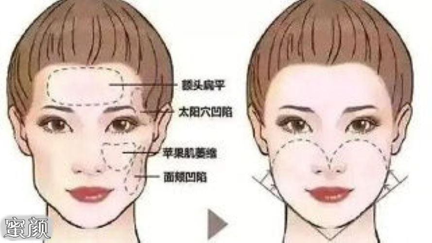 https://img.miyanlife.com/mnt/Editor/2020-11-14/5faf6d594e9bb.jpg