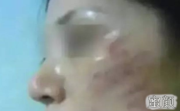 https://img.miyanlife.com/mnt/Editor/2020-11-16/5fb1ebb64b5eb.jpg