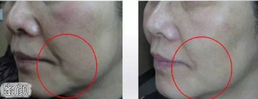 https://img.miyanlife.com/mnt/Editor/2020-11-16/5fb1ebe9a98c1.jpg