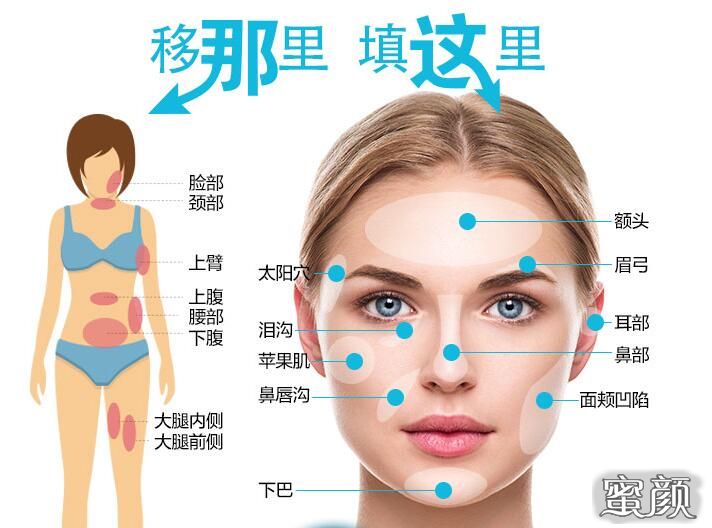 https://img.miyanlife.com/mnt/Editor/2020-11-17/5fb34b4e17e6f.jpg