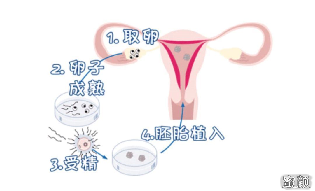 https://img.miyanlife.com/mnt/Editor/2020-11-21/5fb8d4a67138b.jpg