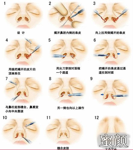 案例图片