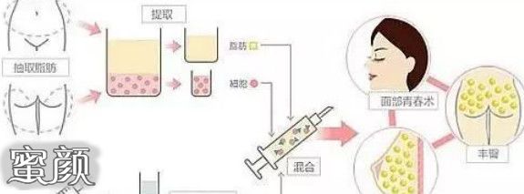 案例图片