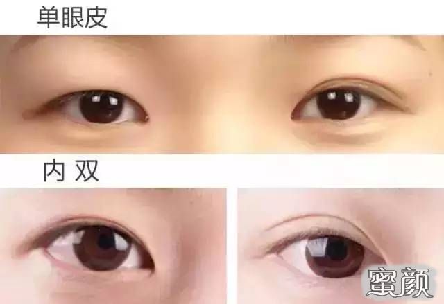 https://img.miyanlife.com/mnt/Editor/2020-11-25/5fbe7e0e0edc4.jpg