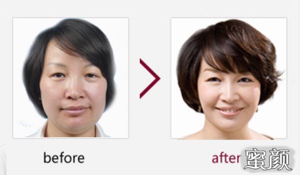https://img.miyanlife.com/mnt/Editor/2020-12-03/5fc85f76d0625.jpg