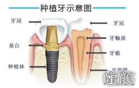 案例图片