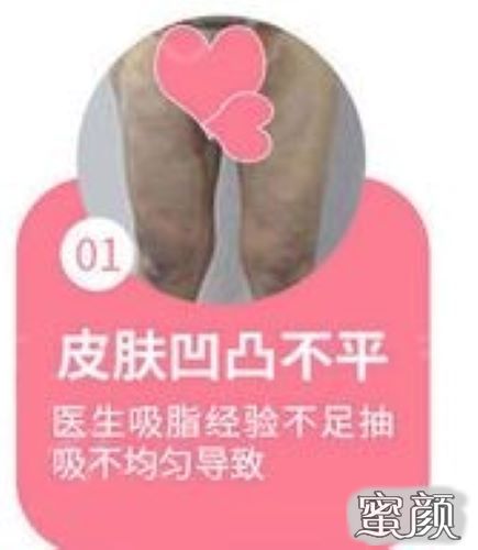 https://img.miyanlife.com/mnt/Editor/2020-12-07/5fce0fe6ca1bd.jpg