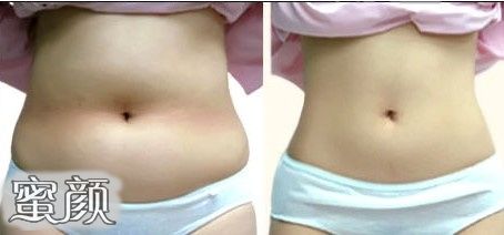https://img.miyanlife.com/mnt/Editor/2020-12-08/5fcebb65067b6.jpg
