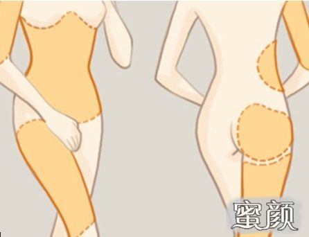 https://img.miyanlife.com/mnt/Editor/2020-12-08/5fcf7d4c32164.jpg