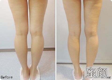 https://img.miyanlife.com/mnt/Editor/2020-12-08/5fcf7dbe34a07.jpg