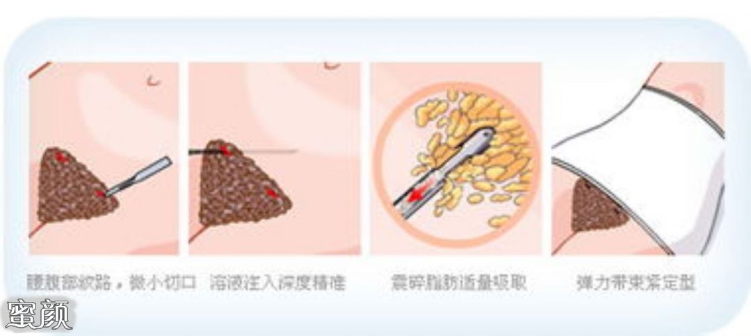 https://img.miyanlife.com/mnt/Editor/2020-12-09/5fd06fd78ed58.jpg