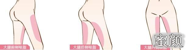 https://img.miyanlife.com/mnt/Editor/2020-12-11/5fd249e0403c1.jpg