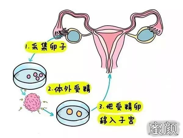 https://img.miyanlife.com/mnt/Editor/2020-12-11/5fd32ce2ae5e3.jpg