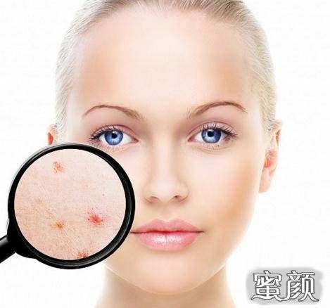 https://img.miyanlife.com/mnt/Editor/2020-12-11/5fd333d61e6d5.jpg