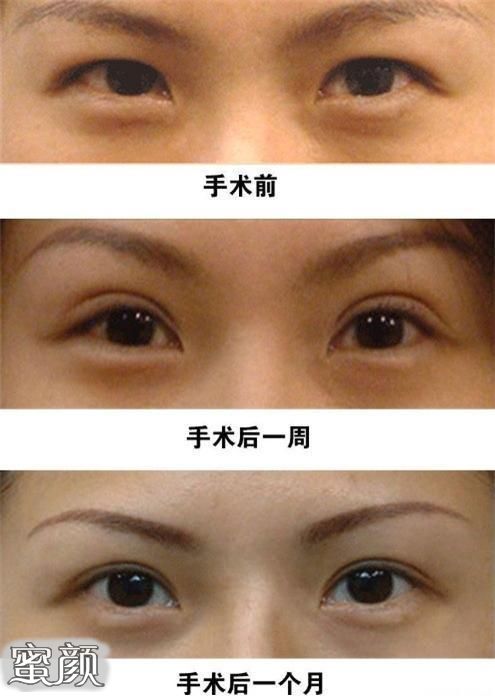 https://img.miyanlife.com/mnt/Editor/2020-12-13/5fd5c4e3bc0ce.jpg