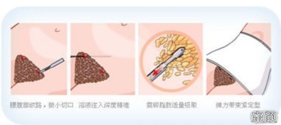https://img.miyanlife.com/mnt/Editor/2020-12-14/5fd77844250d7.jpg