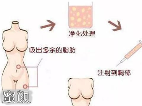 https://img.miyanlife.com/mnt/Editor/2020-12-15/5fd8be2535fc4.jpg