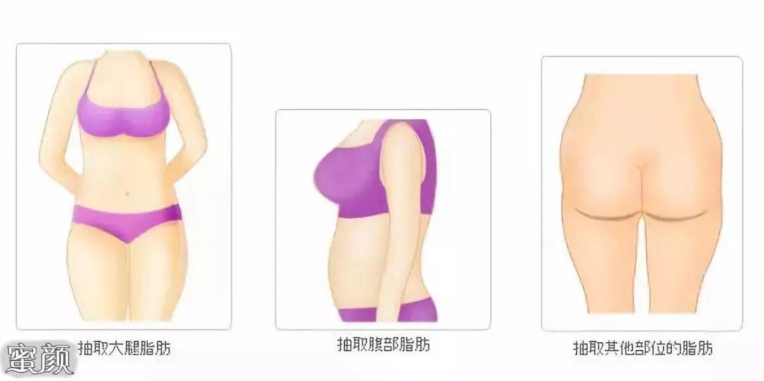 https://img.miyanlife.com/mnt/Editor/2020-12-15/5fd8be56ef02f.jpg