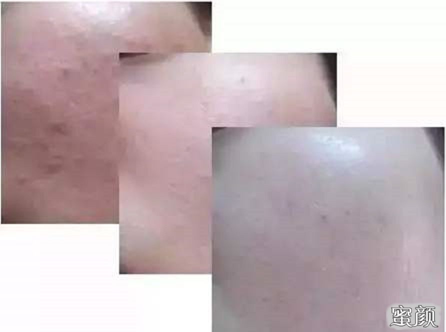 https://img.miyanlife.com/mnt/Editor/2020-12-17/5fdb079052e36.jpg